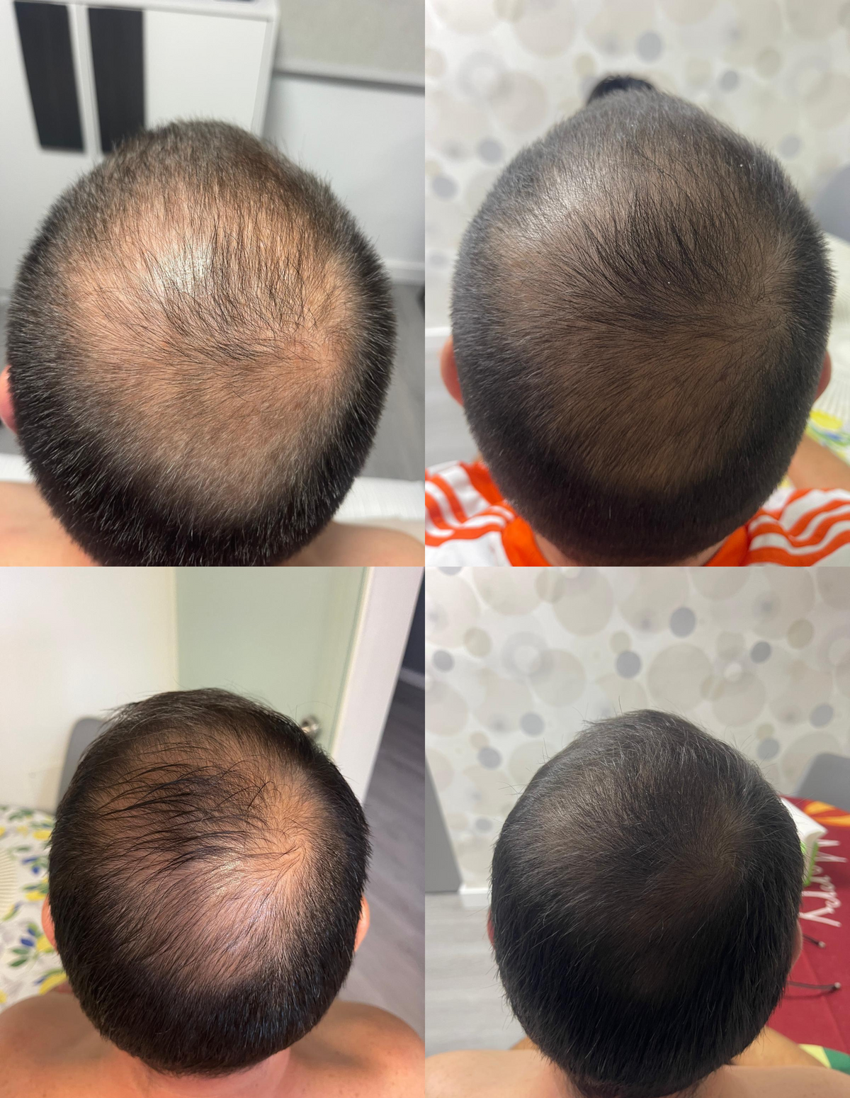 ReHair Therapy Shampoo