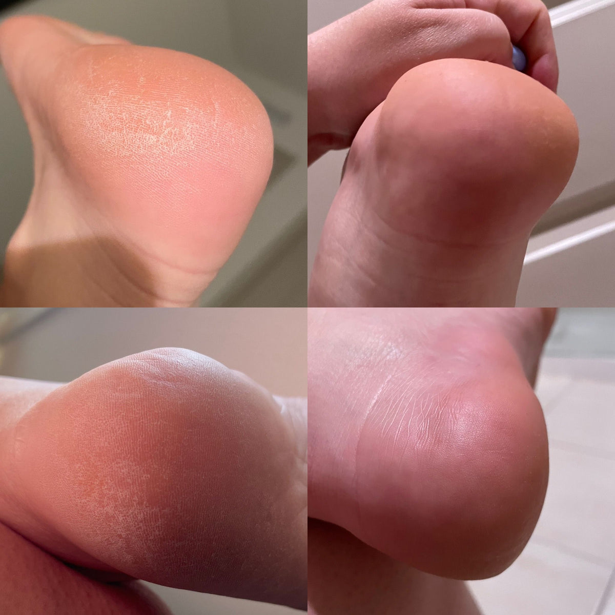 Feet Moisturizing Bomb