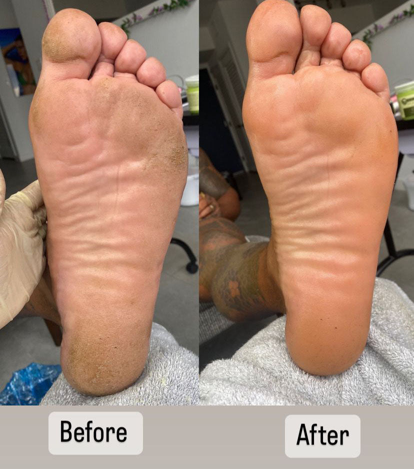 Feet Moisturizing Bomb